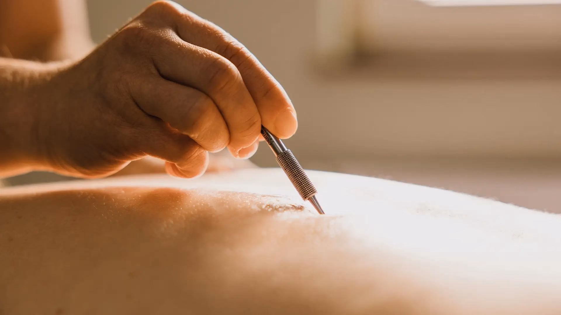 Wer zahlt Akupunktur bei Privatpatienten?