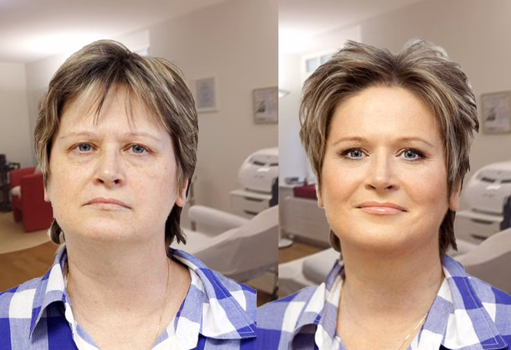 Was ist ein Peeling und Wie funktioniert es?