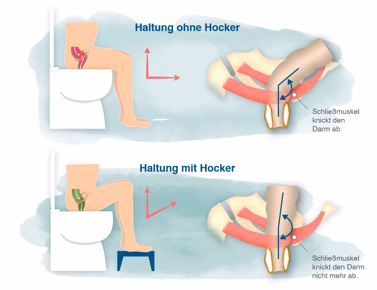 Wie erkenne ich ob ich Blut im Stuhl habe?