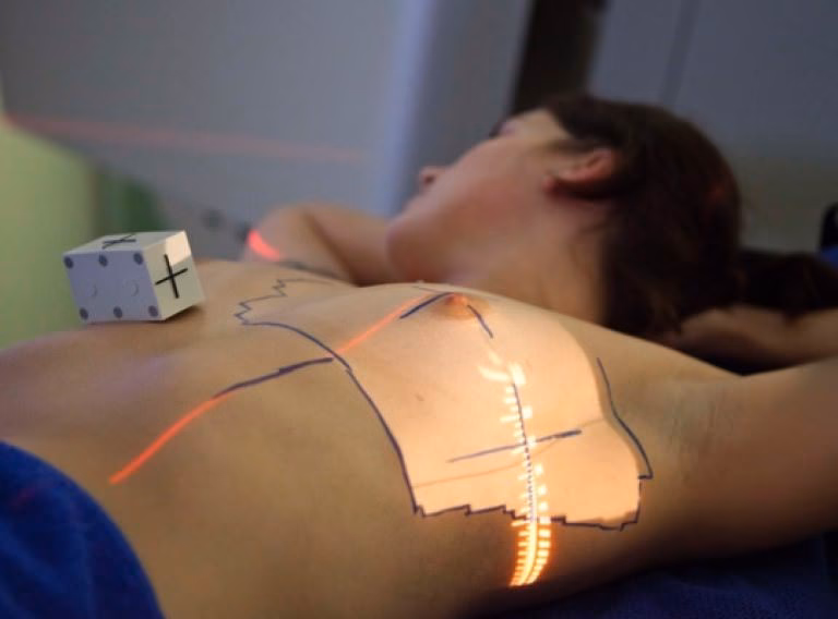 Was sollte man nach einer Strahlentherapie nicht machen?