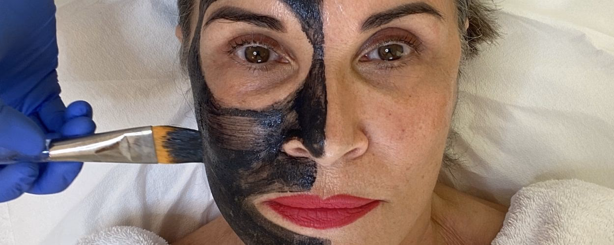 Wie schütze ich mein Gesicht nach einem Peeling?