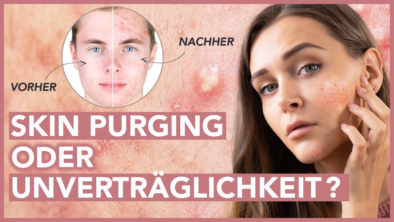 Welche Krankheiten können mit chemischem Peeling behandelt werden?