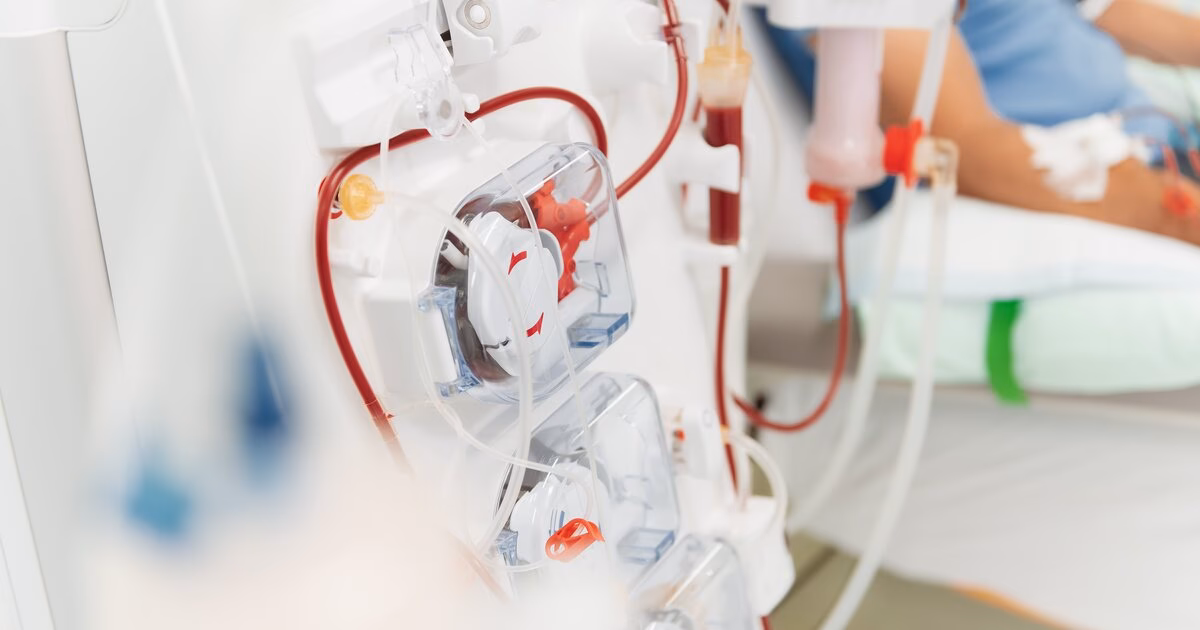 Wie viele Menschen leben mit Dialyse?