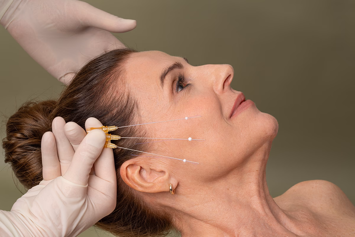 Wie lange darf man nach Fadenzug Schwimmen?