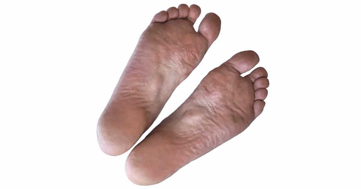 Was tun wenn die Füße Jucken?