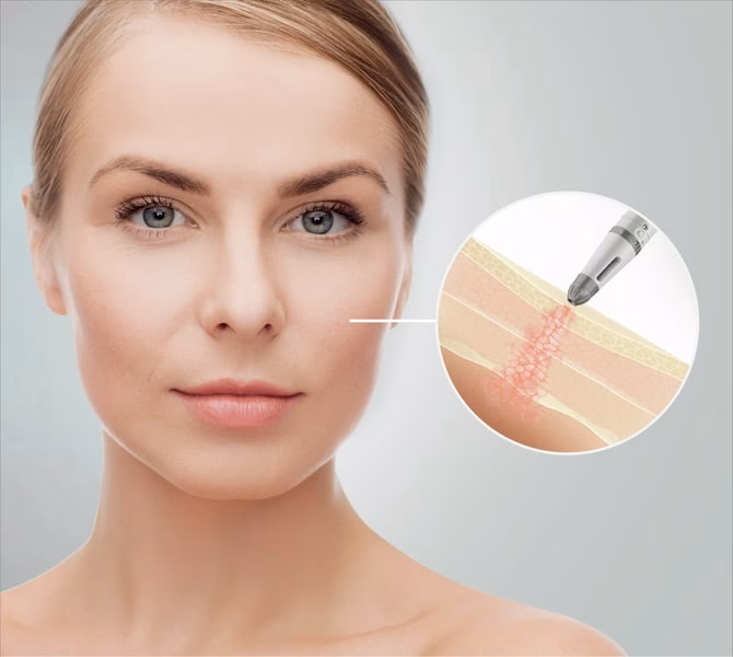 Welche Schönheits-Operationen gibt es?