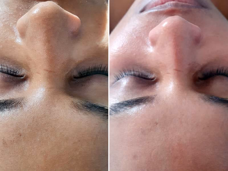 Wie oft sollte man die Poren reinigen?