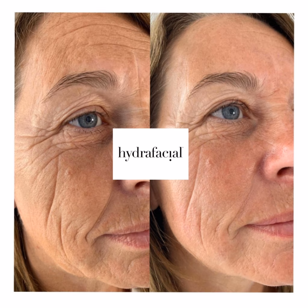 Was bedeuten Pigmentflecken auf der Haut?