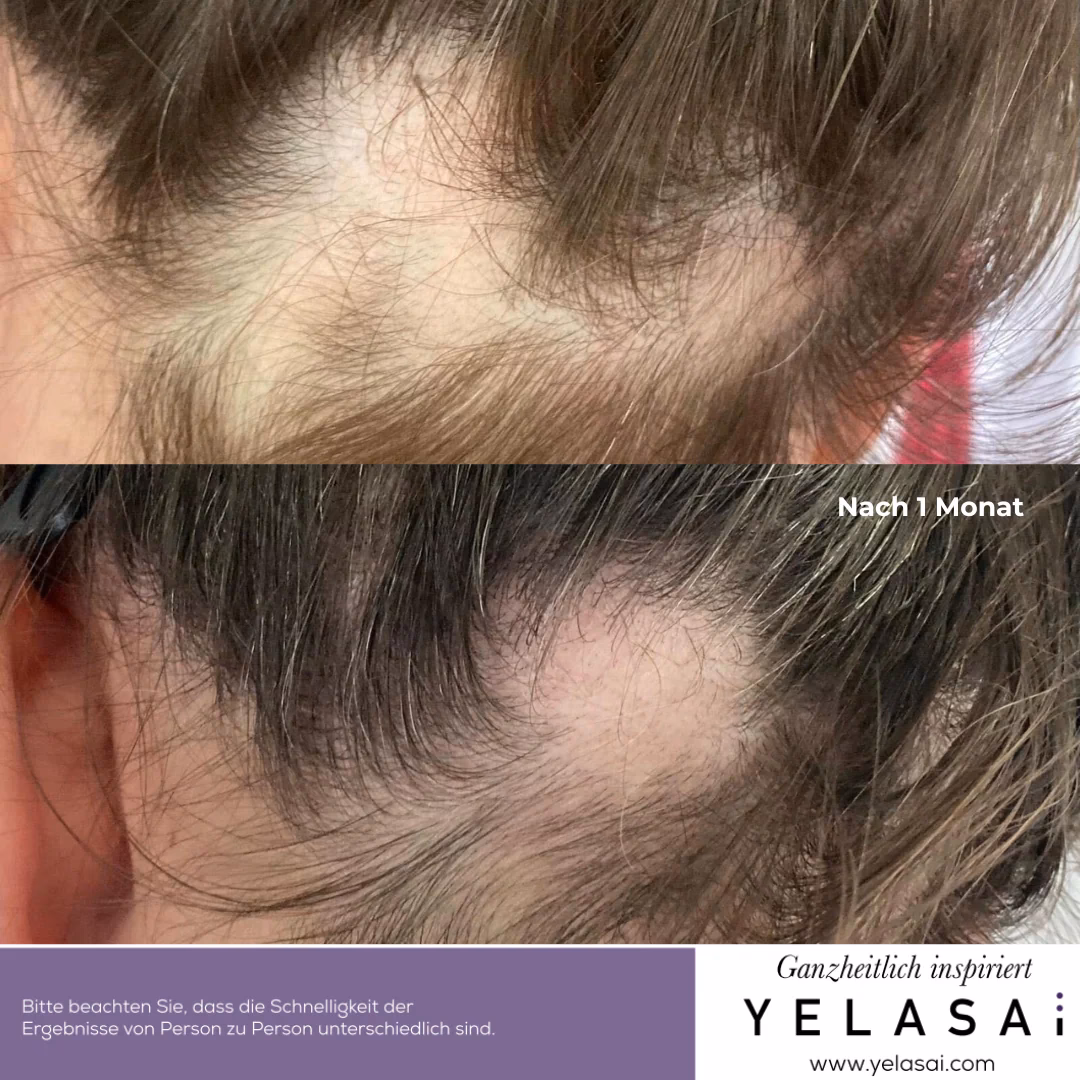 Wie wirkt sich Massage auf die Haare aus?