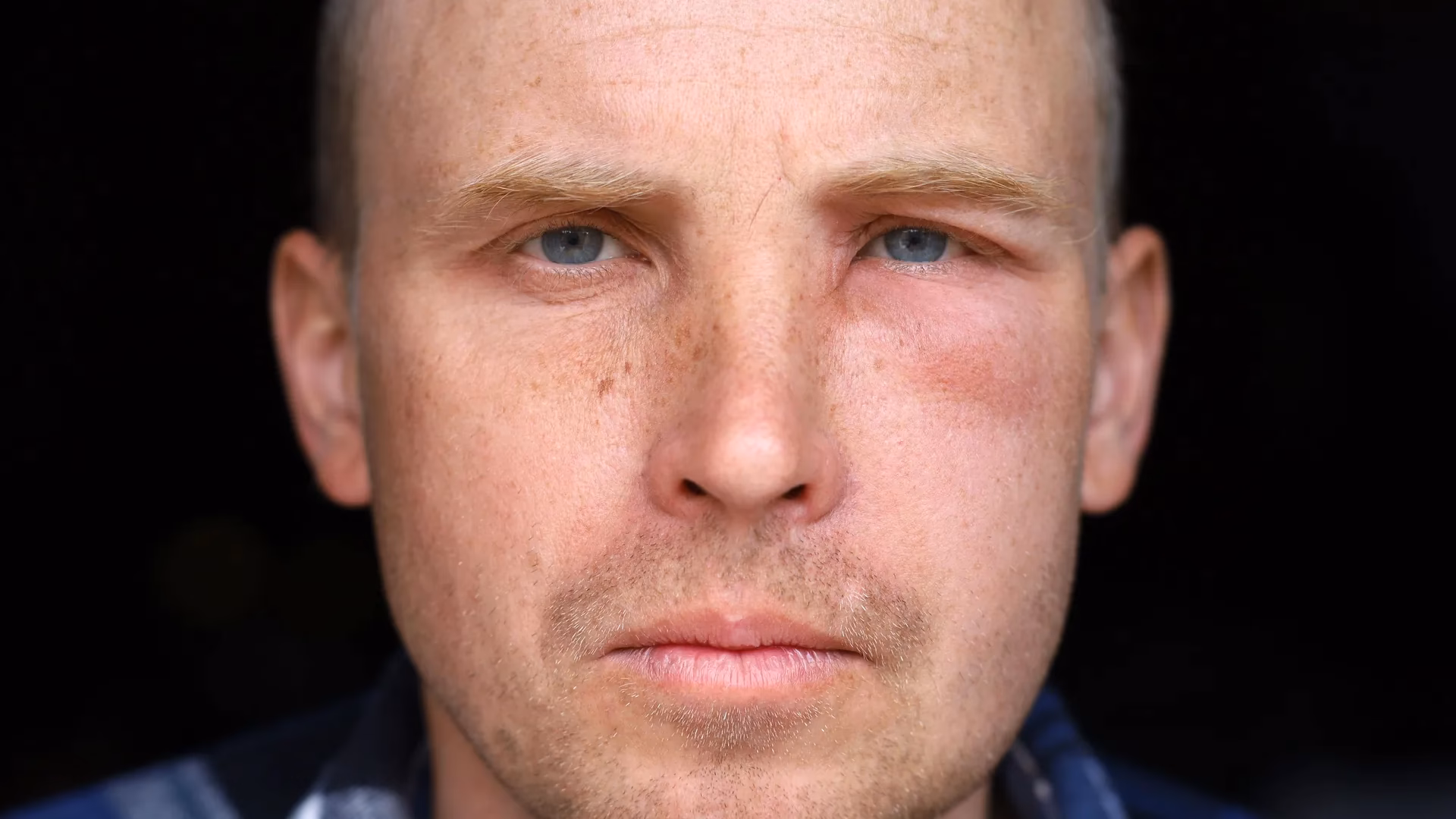 Wie kann man das Anschwellen des Gesichts verhindern?