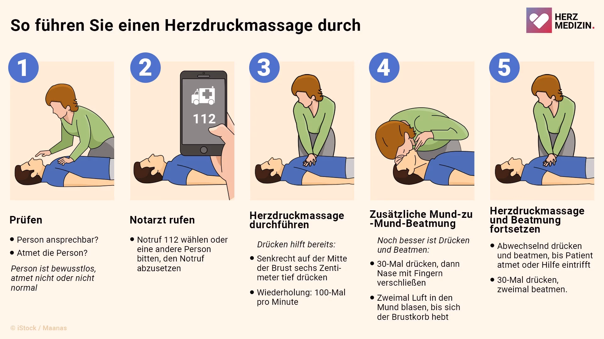 Wie hat sich der Stellenwert der Herzdruckmassage in den letzten Jahren verändert?