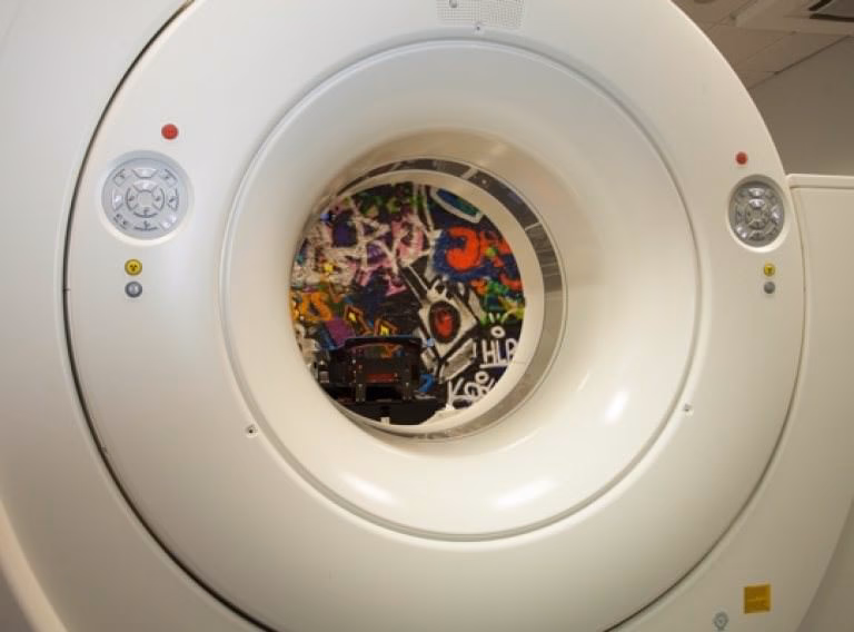 Was tun bei Hirntumor?