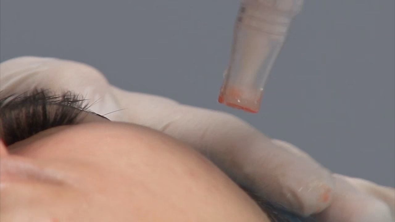 What is HIV Center AHF Mexico?