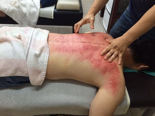 Wie gefährlich ist eine manipulierte Halswirbelsäule?