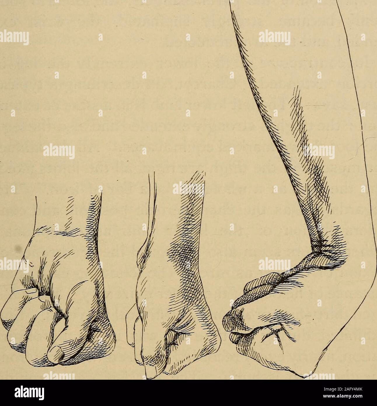 Wie behandelt man Hysterie?