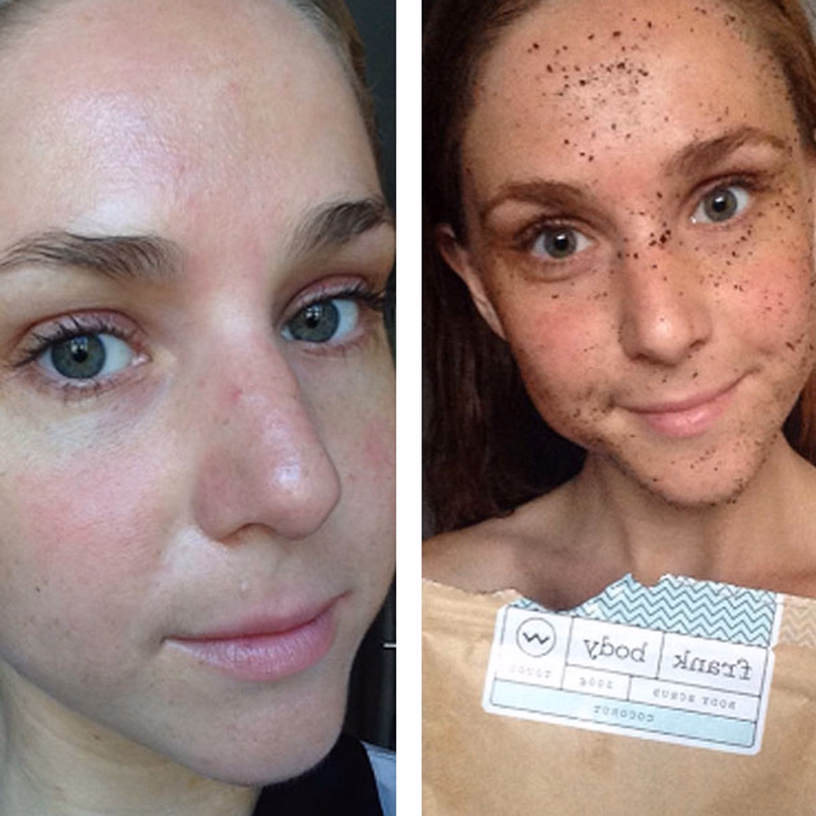 Wie wirkt sich Kaffee auf die Haut aus?