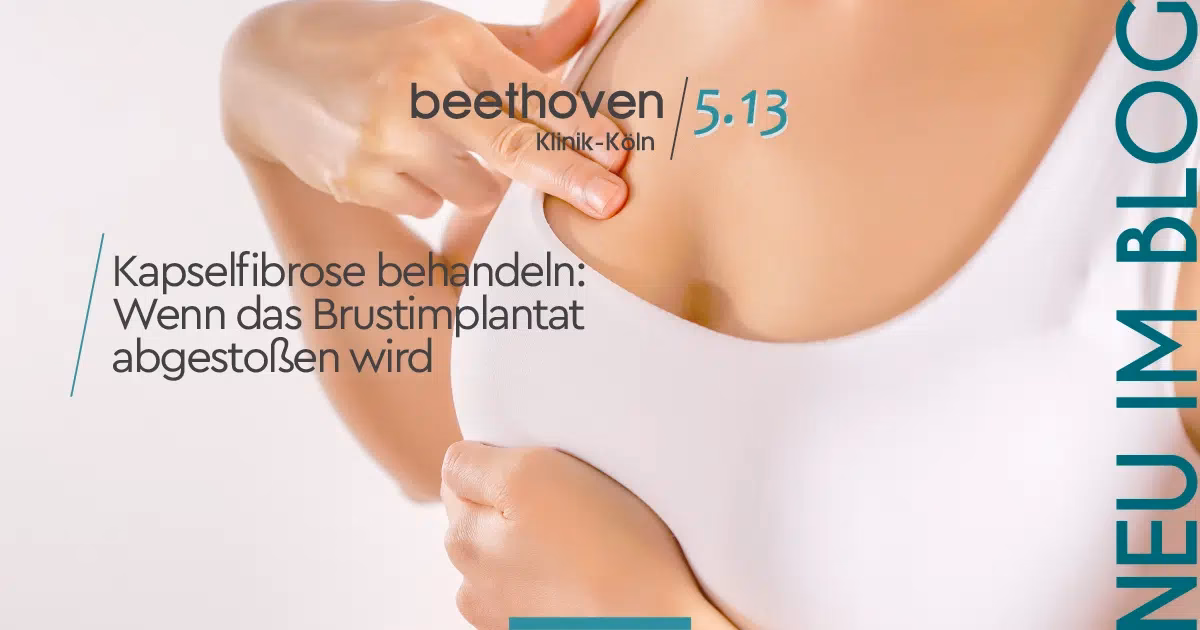 Was ist der Unterschied zwischen einem Implantat und einer Kapselfibrose?