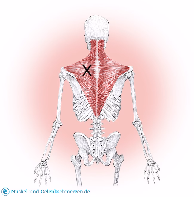 Was ist der Unterschied zwischen einem Nacken und einem Kapuzenmuskel?