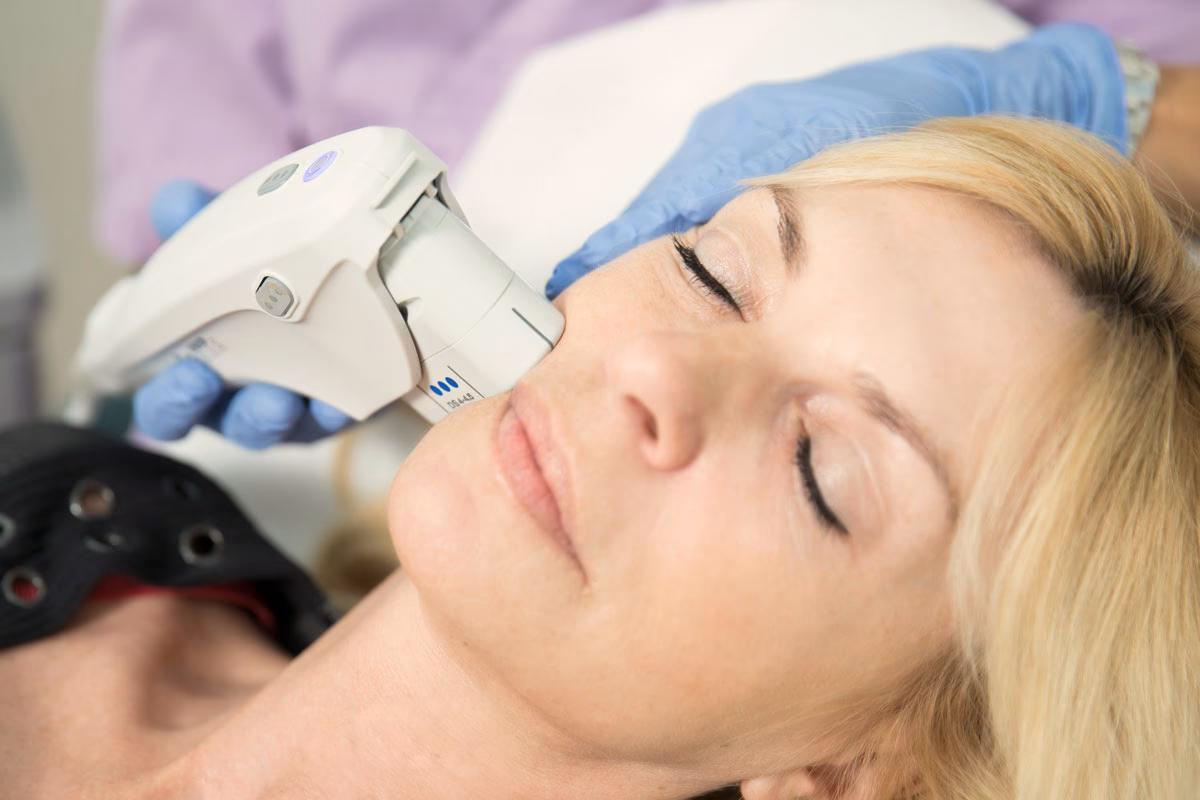 Welche Laserbehandlungen gibt es?