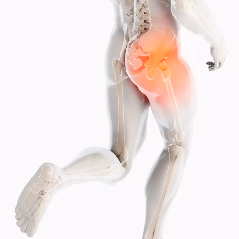 Welche Arten von Schleimbeutelentzündungen gibt es?