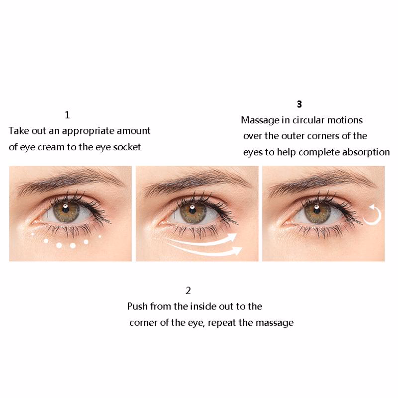 Wie kann man Augenringe loswerden?