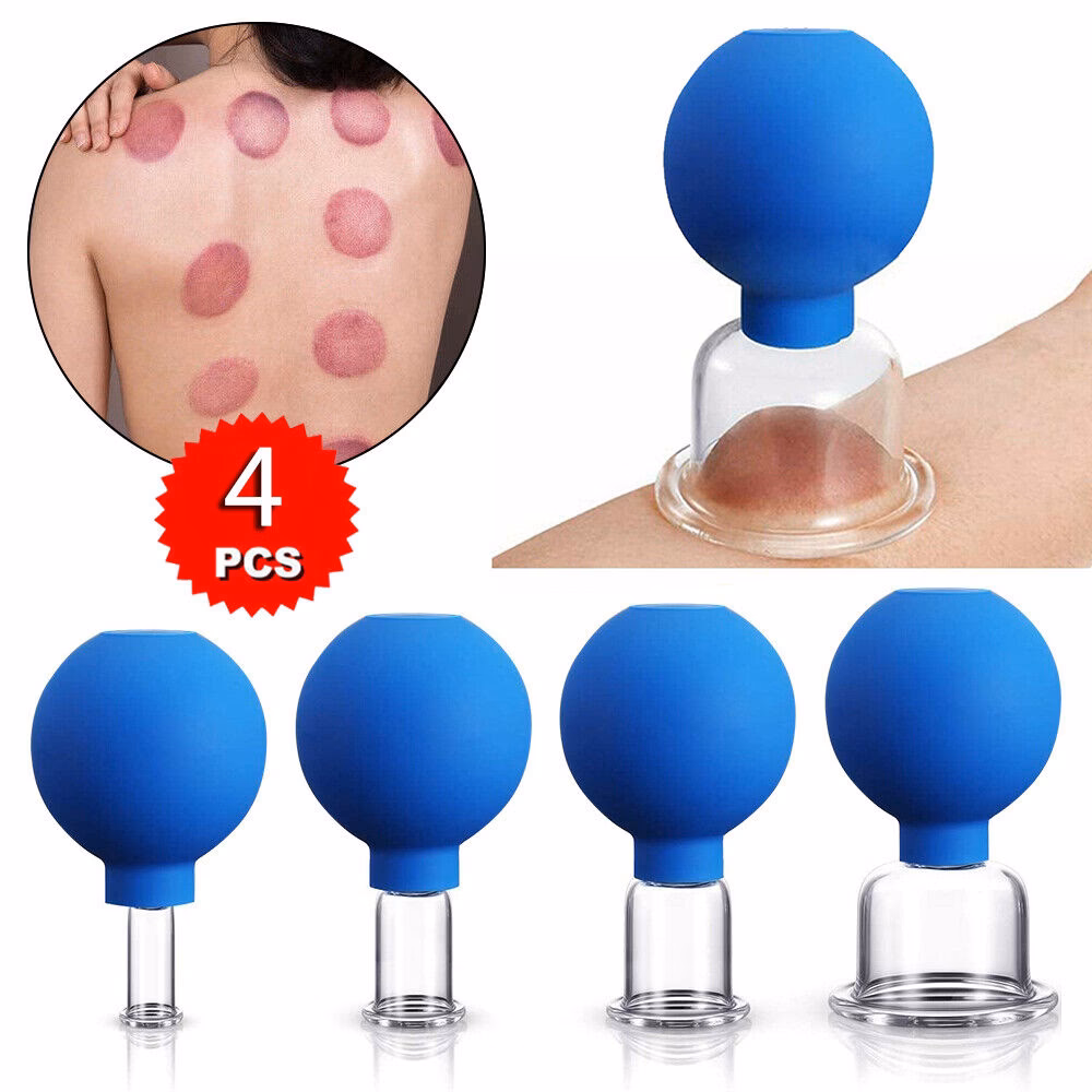 Wie benutze ich Schröpfgläser?