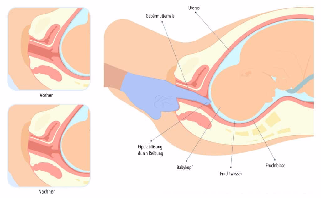 Wie wirkt sich eine Massage auf den Körper aus?