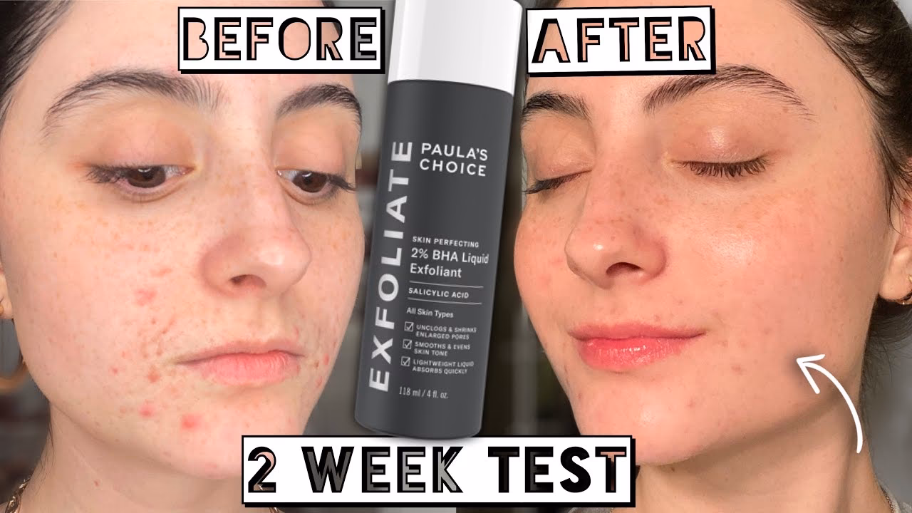 Was ist ein Peeling und wie wirkt es?