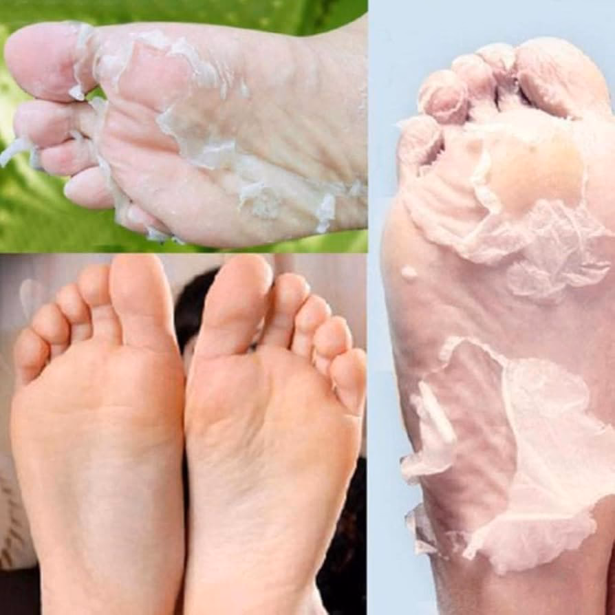 Wie riecht eine Hornhaut Socke?