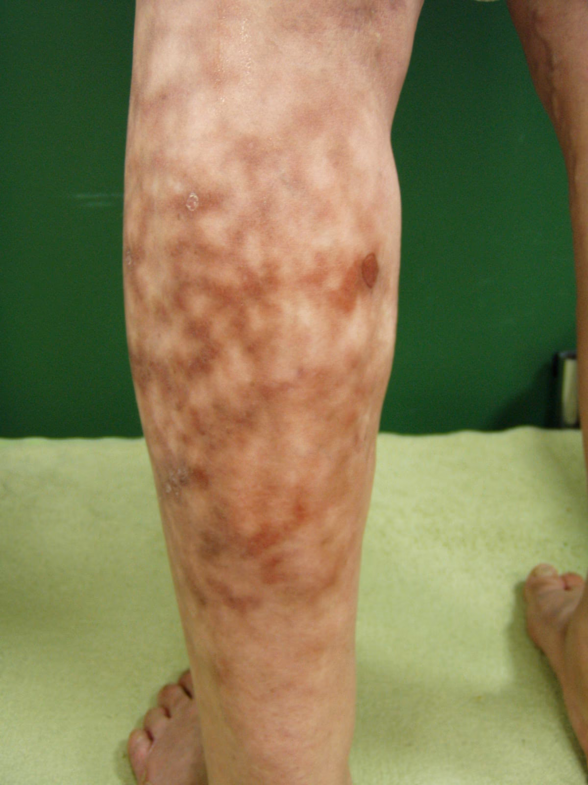 Was hilft gegen trockene Haut nach der Sauna?