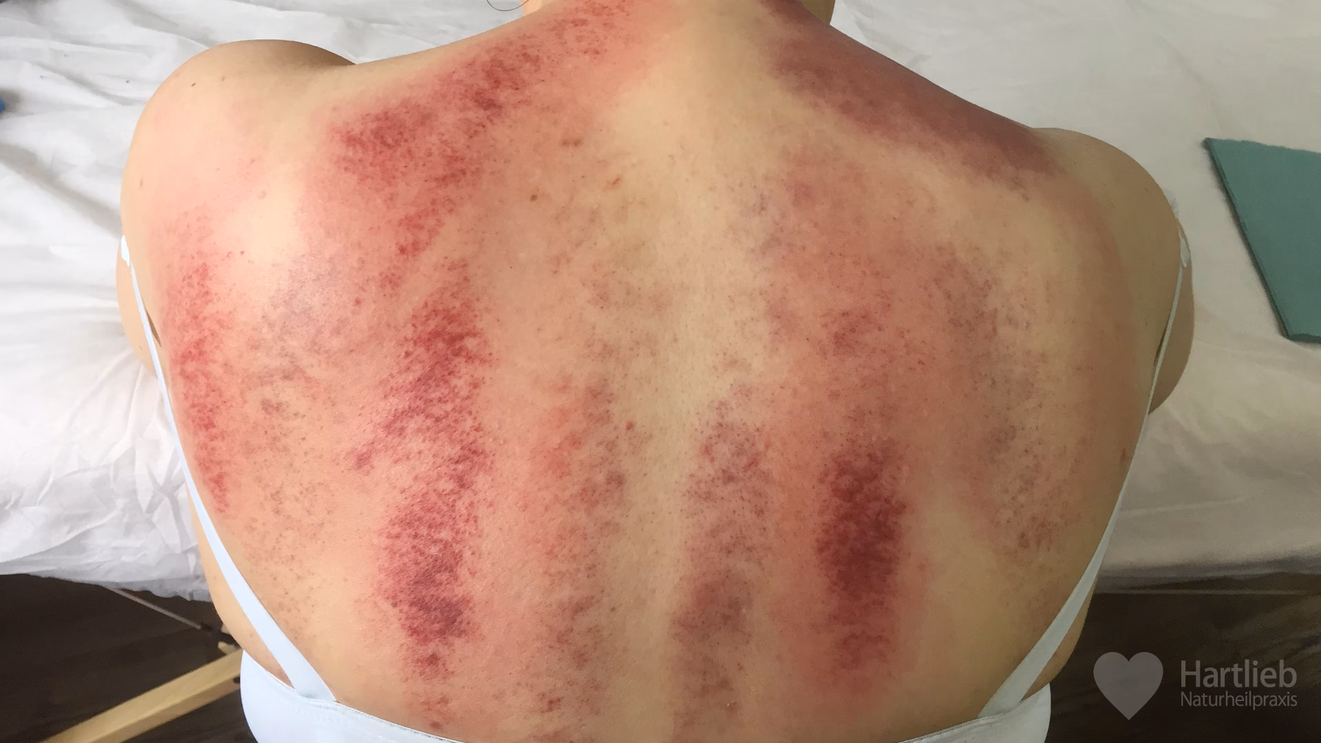 Welche positiven Auswirkungen hat die chinesische Massage?