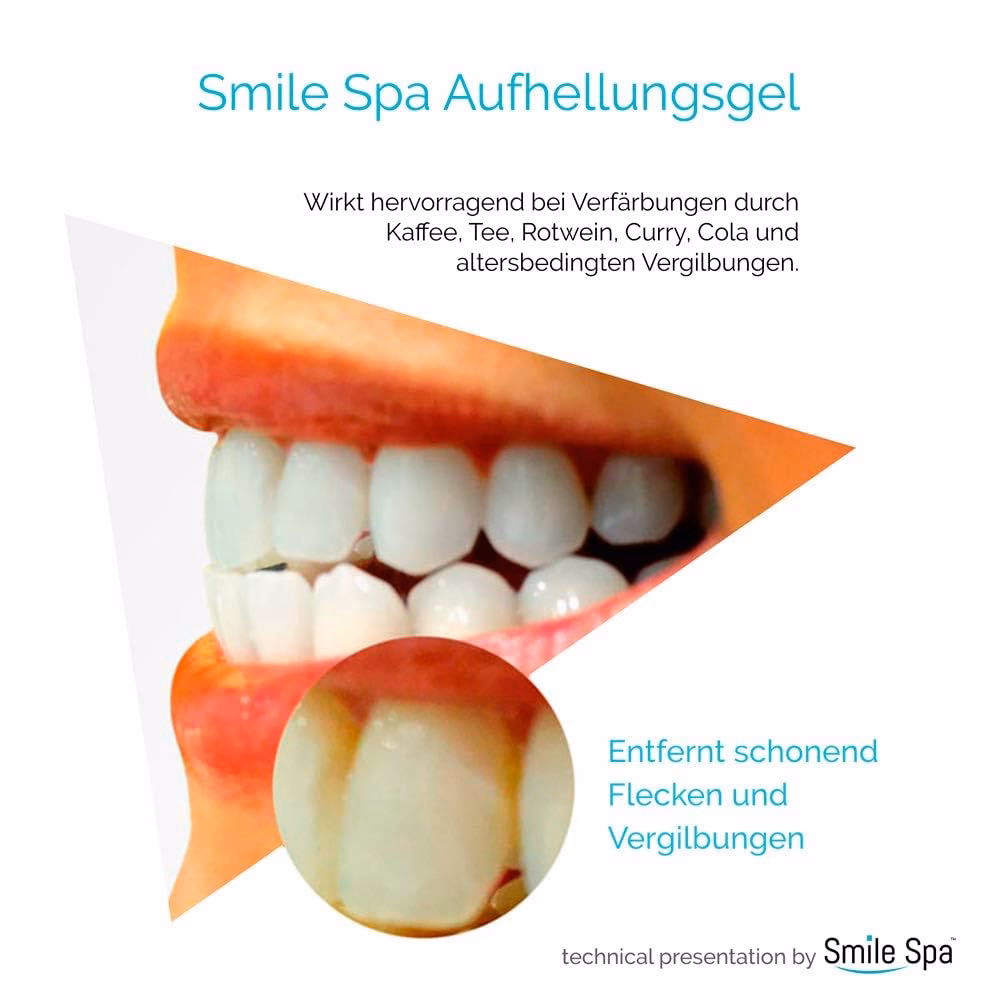 Was ist der Unterschied zwischen Smile Whitening und Bleaching-Lampen?
