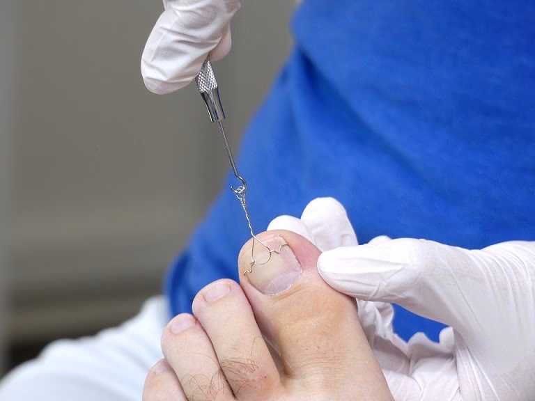 Was ist der Unterschied zwischen Podologe und Fußpflege?